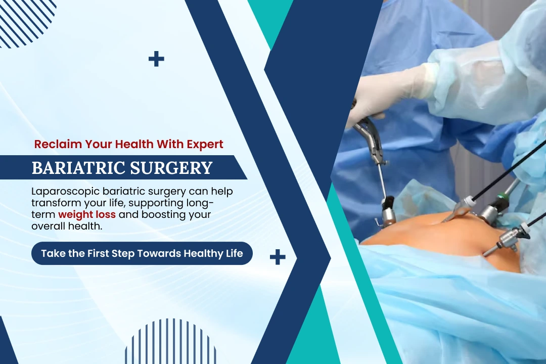 mobile Bariatric SURGERY